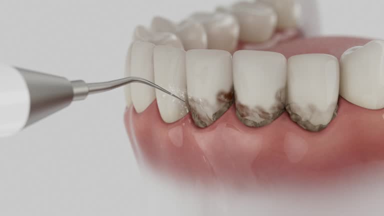 Trusted Dental Crowns And Bridges service in Moorefield, WV - Dentist Open Now